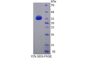 Image no. 1 for ATP-Binding Cassette, Sub-Family G (WHITE), Member 8 (ABCG8) (AA 1-271) protein (His tag) (ABIN6239313) (ABCG8 Protein (AA 1-271) (His tag))
