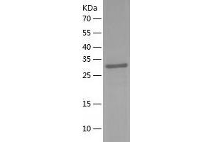 Western Blotting (WB) image for Fructose-1,6-Bisphosphatase 1 (FBP1) (AA 1-338) protein (His tag) (ABIN7123008)