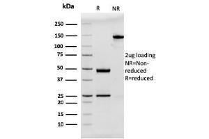 SDS-PAGE Analysis Purified MUC2 Recombinant Mouse Monoclonal Antibody (rMLP/842). (Rekombinanter MUC2 Antikörper)