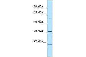 WB Suggested Anti-MPZL3 Antibody Titration: 1.
