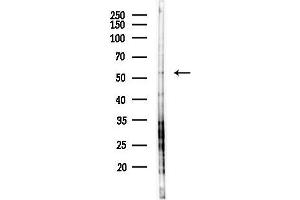 anti-WD Repeat Domain 41 (WDR41) antibody