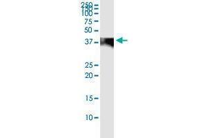 C4BPB (Human) IP-WB Antibody Pair
