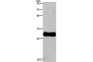 Western blot analysis of Mouse skeletal muscle tissue, using FHL3 Polyclonal Antibody at dilution of 1:1600 (FHL3 Antikörper)