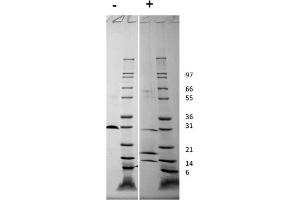 SDS-PAGE of Human Platelet Derived Growth Factor-AB Recombinant Protein SDS-PAGE of Human Platelet Derived Growth Factor-AB Recombinant Protein. (PDGF-AB Heterodimer Protein)
