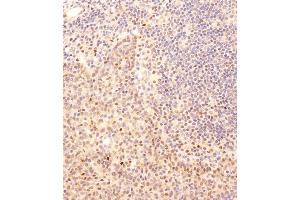 Immunohistochemical analysis of B on paraffin-embedded human tonsil tissue was performed on the Leica®BOND RXm. (SMAD2 Antikörper  (AA 201-230))