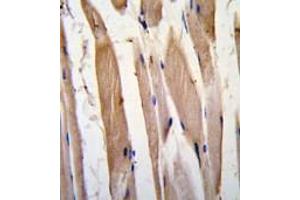 Formalin-fixed and paraffin-embedded human skeletal muscle tissue reacted with VINC antibody (N-term) , which was peroxidase-conjugated to the secondary antibody, followed by DAB staining. (Vinculin Antikörper  (N-Term))