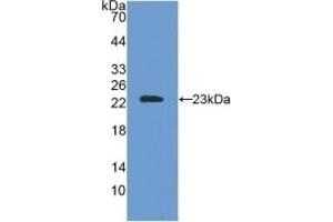 Detection of Recombinant SOD2, Mouse using Polyclonal Antibody to Superoxide Dismutase 2, Mitochondrial (SOD2) (SOD2 Antikörper  (AA 25-222))