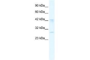 WB Suggested Anti-BRD9 Antibody Titration:  2. (BRD9 Antikörper  (N-Term))