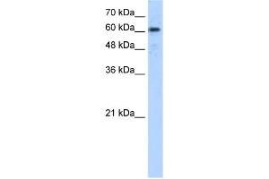 WB Suggested Anti-ADAM30 Antibody Titration:  5. (ADAM30 Antikörper  (N-Term))