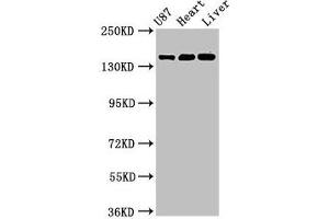 Western Blot Positive WB detected in: U87 whole cell lysate, Rat heart tissue, Mouse liver tissue All lanes: GRIN2A antibody at 3. (NMDAR2A Antikörper  (AA 501-750))