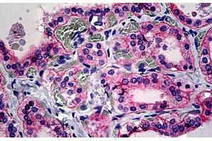 Human Thyroid: Formalin-Fixed, Paraffin-Embedded (FFPE) (CD51 Antikörper  (Cleaved-Lys889))