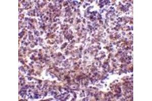 Immunohistochemistry (IHC) image for anti-CD180 Molecule (CD180) (N-Term) antibody (ABIN1031545) (CD180 Antikörper  (N-Term))