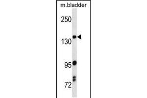 Western blot analysis in mouse bladder tissue lysates (35ug/lane). (ASK1 Antikörper  (C-Term))
