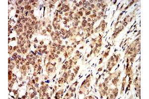 Immunohistochemistry (IHC) image for anti-Cyclin D1 (CCND1) (AA 167-295) antibody (ABIN5862106) (Cyclin D1 Antikörper  (AA 167-295))