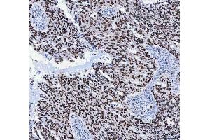 IHC analysis of FEN1 using anti-FEN1 antibody (ABIN7601617). (FEN1 Antikörper  (AA 4-300))