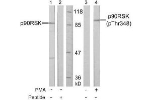 Image no. 3 for anti-Ribosomal Protein S6 Kinase, 90kDa, Polypeptide 1 (RPS6KA1) (pThr348) antibody (ABIN196796) (RPS6KA1 Antikörper  (pThr348))