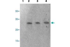 Western blot analysis of Lane 1: antigen-specific peptide treated 293 cells, Lane 2: 293 cells, Lane 3: HeLa cells, Lane 4: HepG2 cells with GAB2 (phospho S623) polyclonal antibody  at 1:500-1000 dilution. (GAB2 Antikörper  (pSer623))