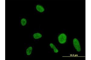 Immunofluorescence of purified MaxPab antibody to DIP2A on HeLa cell. (DIP2A Antikörper  (AA 1-889))