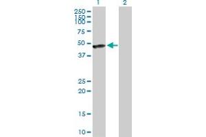 Western Blot analysis of CALR3 expression in transfected 293T cell line by CALR3 MaxPab polyclonal antibody. (Calreticulin 3 Antikörper  (AA 1-384))