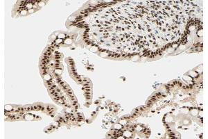 ABIN6266651 at 1/100 staining human colon tissue sections by IHC-P. (NCOR1 Antikörper  (N-Term))