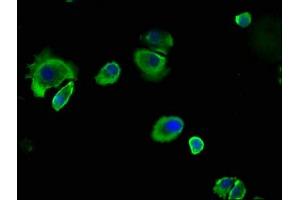 Immunofluorescence staining of MCF-7 cells with ABIN7146799 at 1:133, counter-stained with DAPI. (CEACAM5 Antikörper  (AA 1-255))