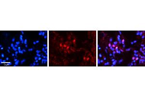 Rabbit Anti-SNRNP70 Antibody     Formalin Fixed Paraffin Embedded Tissue: Human Pineal Tissue  Observed Staining: Nuclear in pinealocytes  Primary Antibody Concentration: 1:100  Secondary Antibody: Donkey anti-Rabbit-Cy3  Secondary Antibody Concentration: 1:200  Magnification: 20X  Exposure Time: 0.