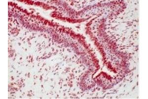 Immunohistochemistry (IHC) image for anti-Progesterone Receptor (PGR) (AA 922-933), (C-Term) antibody (ABIN781660)
