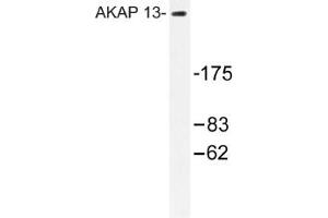 Image no. 1 for anti-A Kinase (PRKA) Anchor Protein 13 (AKAP13) antibody (ABIN317612) (AKAP13 Antikörper)