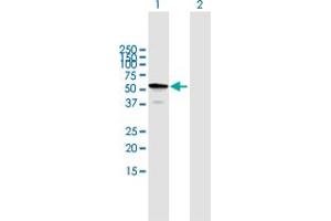 TBC1D22B Antikörper  (AA 1-505)