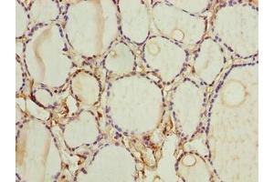 Immunohistochemistry of paraffin-embedded human thyroid tissue using ABIN7153105 at dilution of 1:100 (FOXR2 Antikörper  (AA 1-300))