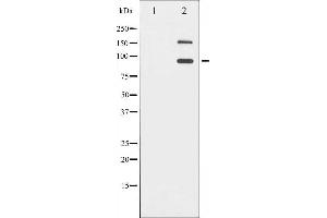 Western Blotting (WB) image for anti-Insulin-Like Growth Factor 1 Receptor (IGF1R) (pTyr1165), (pTyr1166) antibody (ABIN6255780)