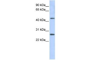 WB Suggested Anti-PRAMEF10 Antibody Titration: 0. (PRAMEF10 Antikörper  (Middle Region))