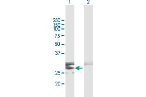 Western Blotting (WB) image for anti-C-Type Lectin Domain Family 9, Member A (CLEC9A) (AA 1-241) antibody (ABIN531526)