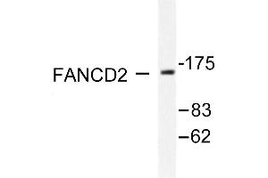 Image no. 3 for anti-Fanconi Anemia, Complementation Group D2 (FANCD2) antibody (ABIN265413) (FANCD2 Antikörper)