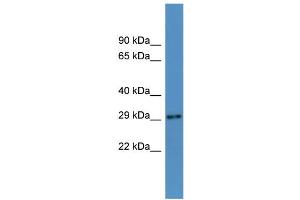 WB Suggested Anti-Auh Antibody Titration:  0. (AUH Antikörper  (N-Term))