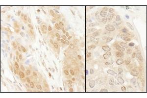 Immunohistochemistry (IHC) image for anti-Parkinson Protein 7 (PARK7) (C-Term) antibody (ABIN7454672)