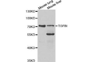 Western blot analysis of extracts of various cell lines, using TGFBI antibody. (TGFBI Antikörper  (AA 481-683))