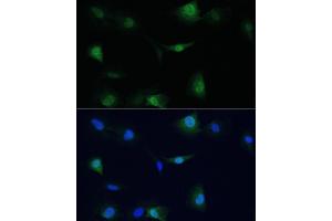 Immunofluorescence analysis of C6 cells using VCP antibody (ABIN6128632, ABIN6150072, ABIN6150073 and ABIN6217335) at dilution of 1:100.