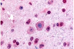 Mouse, Brain (formalin-fixed, paraffin-embedded) stained with GLI2 antibody ABIN214612 at 5 ug/ml followed by biotinylated goat anti-rabbit IgG secondary antibody ABIN481713, alkaline phosphatase-streptavidin and chromogen. (GLI2 Antikörper  (Internal Region))