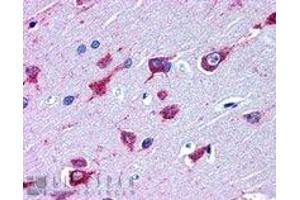 Immunohistochemistry (IHC) image for anti-Amyotrophic Lateral Sclerosis 2 (Juvenile) (ALS2) (C-Term) antibody (ABIN2465394) (ALS2 Antikörper  (C-Term))