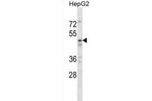 Western Blotting (WB) image for anti-TAP Binding Protein-Like (TAPBPL) antibody (ABIN2998744)