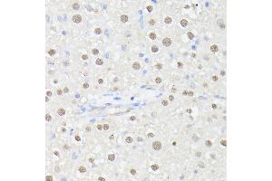 Immunohistochemistry of paraffin-embedded rat liver using MLF2 antibody (ABIN7268725) at dilution of 1:100 (40x lens). (MLF2 Antikörper  (AA 1-65))