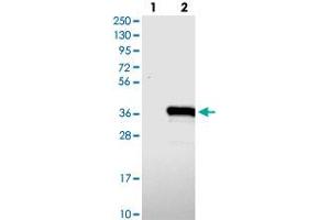 Western blot analysis of Lane 1: Negative control (vector only transfected HEK293T lysate), Lane 2: Over-expression Lysate (Co-expressed with a C-terminal myc-DDK tag (~3. (TYW3 Antikörper)