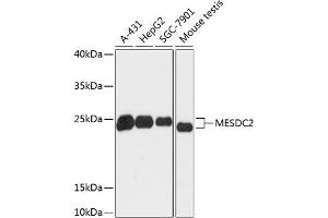 Western blot analysis of extracts of various cell lines, using MESDC2 antibody (ABIN6128279, ABIN6143742, ABIN6143744 and ABIN6218106) at 1:3000 dilution. (MESDC2 Antikörper  (AA 1-234))