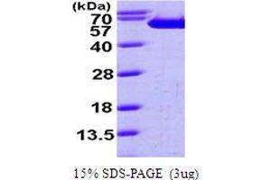 SDS-PAGE (SDS) image for Fascin (FSCN1) (AA 1-493) protein (His tag) (ABIN5779717) (Fascin Protein (FSCN1) (AA 1-493) (His tag))