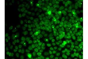 Immunofluorescence analysis of MCF7 cells using UFD1L antibody (ABIN1683208, ABIN5664259, ABIN5664261 and ABIN6220174). (UFD1L Antikörper  (AA 1-307))