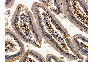 ABIN6260362 and ABIN6277991 at 1/100 staining mouse colorectal tissue by IHC-P.