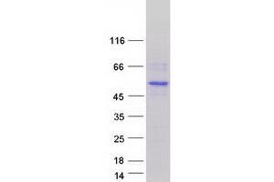 Western Blotting (WB) image for Interferon Regulatory Factor 2 (IRF2) protein (Myc-DYKDDDDK Tag) (ABIN2723788)