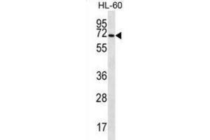 Western Blotting (WB) image for anti-Solute Carrier Family 6 (Amino Acid Transporter), Member 14 (Slc6a14) antibody (ABIN2997057) (Slc6a14 Antikörper)