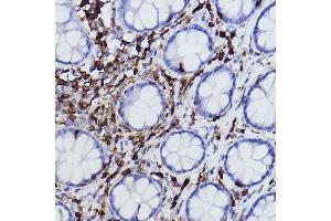 Immunohistochemistry of paraffin-embedded human colon using L-Plastin/LCP1 Rabbit mAb (ABIN7268317) at dilution of 1:100 (40x lens). (LCP1 Antikörper)